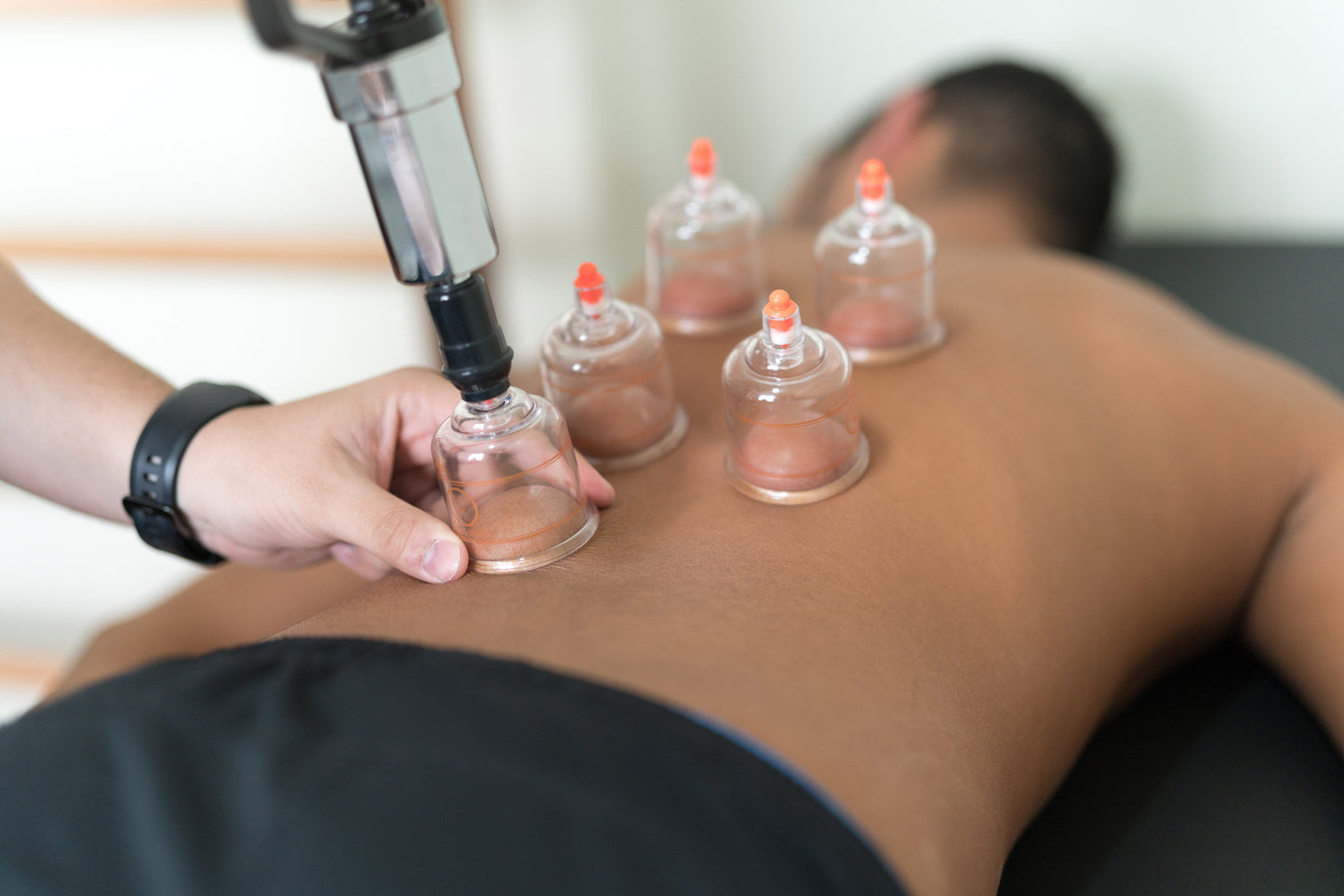 ADD ON - CUPPING THERAPY